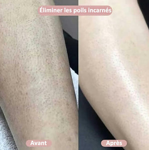 Rasoir électrique 2 en 1 pratique pour femme - Qualité premium + Livraison GRATUITE