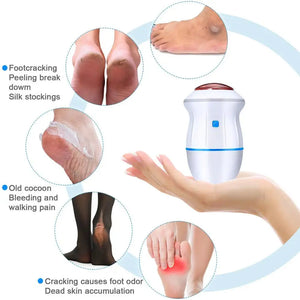 Ponceuse électrique rechargeable pour les pieds